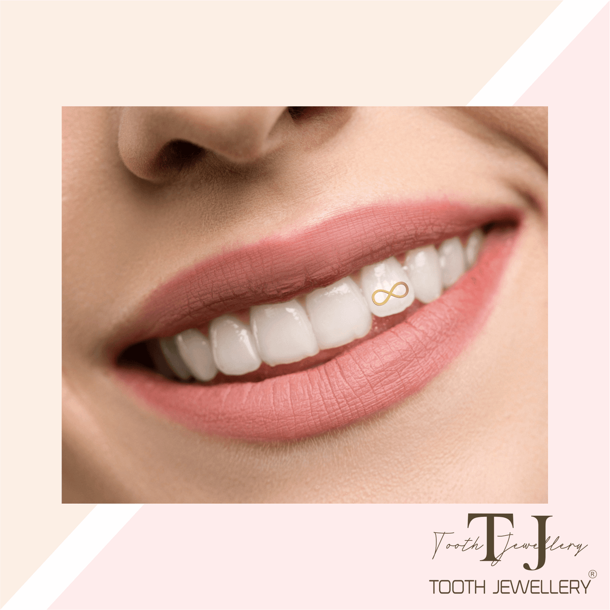 String Gold Tooth Gold Tooth Charms